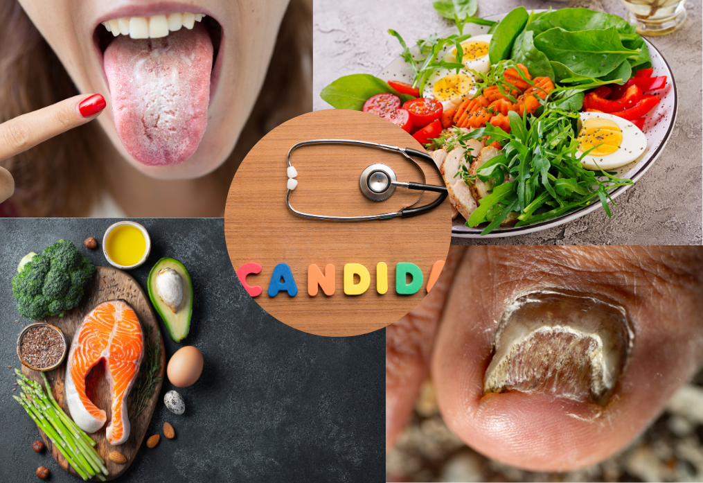 A collage of various foods and words that describe candida.